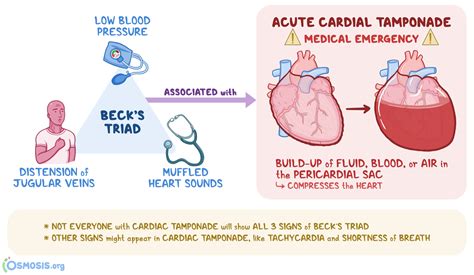 becks triad medical.